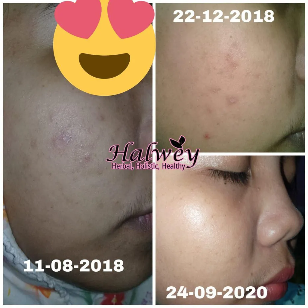 Day Cream Lightening Glutathione, 15gr - Image 8